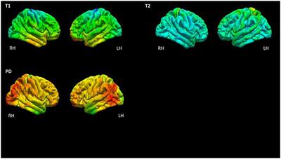 Focal epilepsy without overt epileptogenic lesions: no evidence of microstructural brain tissue damage in multi-parametric quantitative MRI